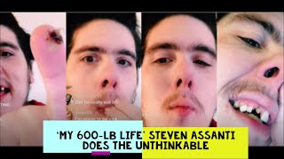 ‘My 600LB Life’ Steven Assanti [upl. by Trimble]