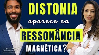 Diagnóstico da Distonia  Distonia Aparece na Ressonância Magnética  Dr Diego de Castro [upl. by Noli]