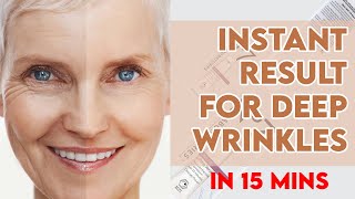 HOW TO TREAT AGING  No7 line fix lifting serum  Instant results  works in 15 mins reduces [upl. by Enilegna531]