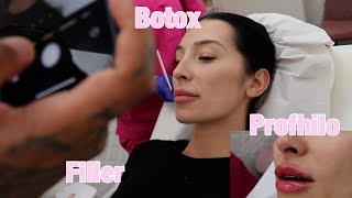 LIPS DISSOLVED REFILLED BOTOX AND PHROFILIO BUSY WEEKLY VLOG ISLY BROKE HER THUMB [upl. by Areyk]