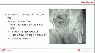 IM nail vs SHS for intertrochanteric femur fractures  debate [upl. by Aenert318]