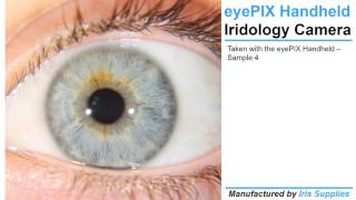 eyePIX Handheld Iridology Camera [upl. by Gabriel]