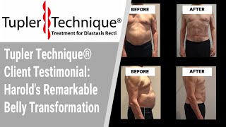 Tupler Technique® Client Testimonial Harolds Remarkable Belly Transformation [upl. by Brentt]