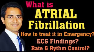 ATRIAL FIBRILLATION AFIB TREATMENT ECG INTERPRETATION PATHOPHYSIOLOGY AFIB MANAGEMENT LECTURE [upl. by Jezabel]