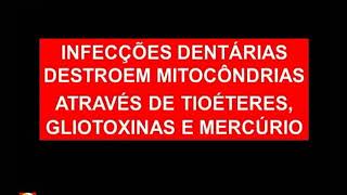 Dr Lair Ribeiro Tratamento de Canal dentário como foco de doenças crônicas [upl. by Massiw628]