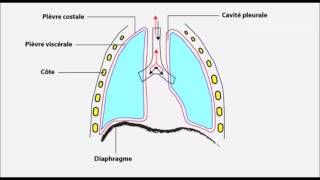 Pleurésie inflammation de la plèvre [upl. by Sindee]