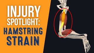 Injury Spotlight Hamstring Strain [upl. by Klenk]