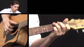 Caledonia Acoustic Guitar Lesson  Fingerstyle Guitar Lesson [upl. by Rodrigo]