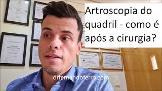 Artroscopia para impacto do quadril femoroacetabular  como é o pósoperatório [upl. by Dopp]