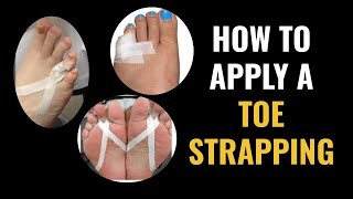 How Do I Do Toe Strapping Dislocated and Fractured Toe [upl. by Hailat893]