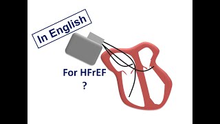 ESC Guidelines CRT for HFrEF English Version [upl. by Ynaoj]