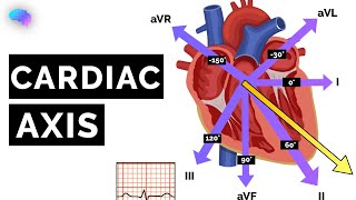 Cardiac Axis Explained  ECG  EKG  OSCE Guide  UKMLA  CPSA [upl. by Hartley]