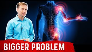 The Bigger Problem with Chronic Inflammation [upl. by Slifka496]