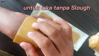 DuoDerm Extra Thin Apakah Bisa Untuk Luka Ca mamae  RaFer QnA [upl. by Godden]