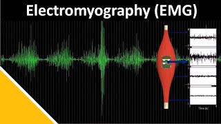 EMG Electromyography in Biomechanics  Delsys [upl. by Ikkela551]