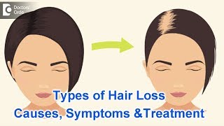 Types of Hair Loss  Common Causes Symptoms amp Treatment  Dr Kavitha GV Mandal [upl. by Gearard]