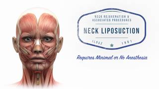 Neck Lift 101 Plastic Surgery Techniques for the Neck  Aesthetic Minutes NeckLift [upl. by Kask479]