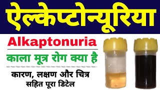 Alkaptonuria in hindi class 12 biology  black urine disease  ऐल्केप्टोन्यूरिया Biology ScienceSK [upl. by Ruhnke342]