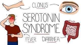 Serotonin Syndrome Explained Serotonin Toxicity [upl. by Velick]