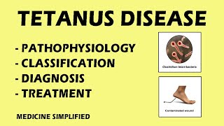 Tetanus  Tetanus Pathophysiology  Tetanus Classification  Tetanus Treatment medicine [upl. by Ciapas881]