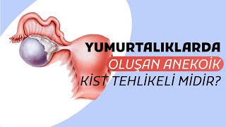 Anekoik Kist Nedir Yumurtalıklarda Oluşan Anekoik Kistler Tehlikeli Midir  Prof Dr Gamze Sinem [upl. by Rodama354]