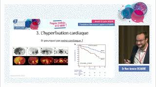 La scintigraphie osseuse dans l’amylose à transthyrétine  intérêt et limites [upl. by Ahsaetal408]