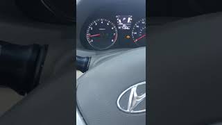 Diagnosing a stall condition 2013 hyundai elantra [upl. by Nylhtak395]