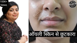 Fusidic acid cream uses in hindi  benefits of fusidic acid cream  fucidin cream review [upl. by Aitat]