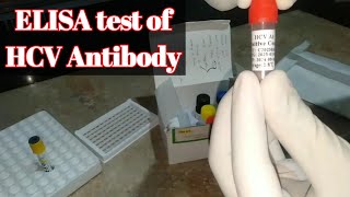 Procedure of HCV antibody test by ELISA technique [upl. by Landrum]