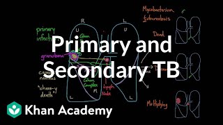 Primary and Secondary TB  Infectious diseases  NCLEXRN  Khan Academy [upl. by Wehhtam]