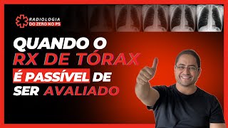 Quando o RX de tórax está passível de ser avaliado [upl. by Par]