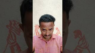 My Crown Area without Hair transplant haircut hairloss haircare [upl. by Deny]