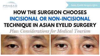 Extra Fat and Skin Determine Type of Asian Eyelid Surgery  Considerations for Medical Tourism [upl. by Sarine]