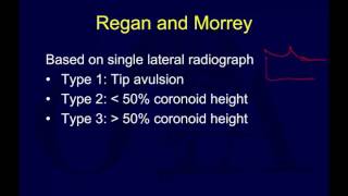 Traumatic elbow instability  terrible triad OTA lecture series IV u06b [upl. by Collin410]