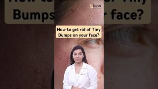 What is Milia on the face  How to treat milia  Dermatologist in Hyderabad [upl. by Daron]