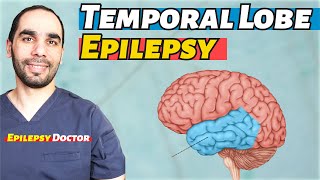 Temporal Lobe Epilepsy Diagnosis and Treatment [upl. by Yliram196]