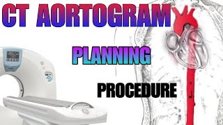 CT AORTOGRAM  planning and procedure explained [upl. by Anisirhc251]