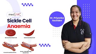 Sickle Cell Anaemia  Pathogenesis  Factors  Diagnosis by DR Priyanka Sachdev  MedLive [upl. by Cammy]