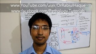 Embolism  Definition Types Pathogenesis Clinical Consequences HD [upl. by Atiuqehc632]