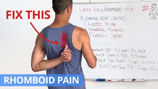 How to Fix Upper Back  Rhomboid Pain for GOOD 4 Effective Exercises [upl. by Adiell]