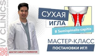 Сухая игла в SEMISPINALIS CAPITIS Полуостистая мышца  Мастеркласс постановки сухой иглы [upl. by Hakeber]