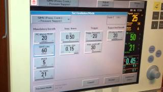 Neonatal Mechanical Ventilation CBO [upl. by Myke]