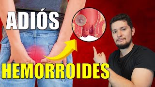 💥 ¡ALERTA HEMORROIDES  Síntomas Causas y Tratamiento  CURA las HEMORROIDES de MANERA NATURAL [upl. by Aisirtap]