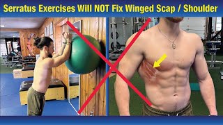 Winged Scapula CAN NOT BE FIXED Doing Serratus Anterior Exercises Correct the Problem [upl. by Erret]