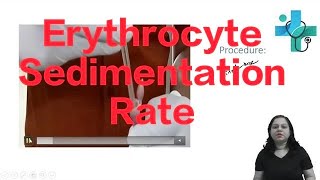 Erythrocyte Sedimentation Rate  haematology  physiology practical [upl. by Nawiat96]