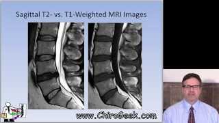 Dr Gillard lectures on How to Read Your Lumbar MRI [upl. by Fernanda733]