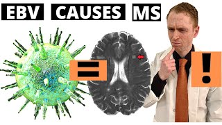 EpsteinBarr Virus Causes Multiple Sclerosis US Military Longitudinal Study [upl. by Sylirama]