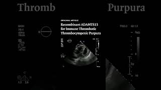 Recombinant ADAMTS13 for Immune Thrombotic Thrombocytopenic Purpura  NEJM [upl. by Bricker]