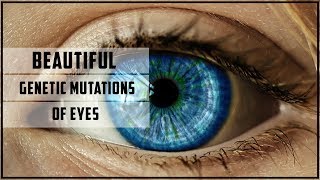 Beautiful genetic mutations of eyes [upl. by Tandie91]