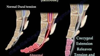 Coccyx Tailbone pain coccydynia  Everything You Need To Know  Dr Nabil Ebraheim [upl. by Ramburt568]